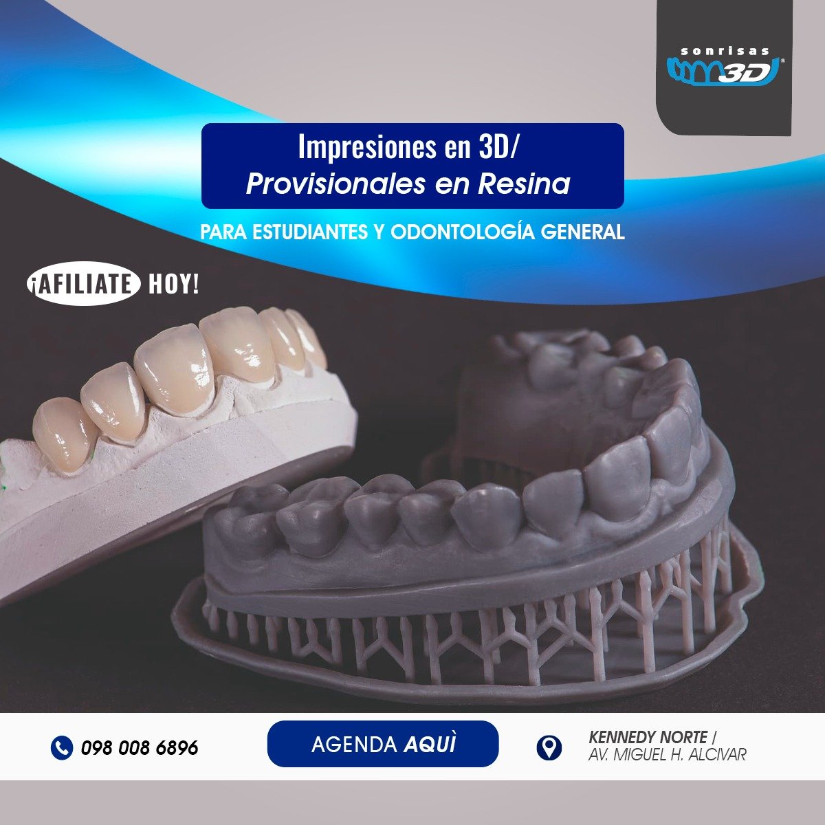 Impresión 3D de modelos provisionales en resina para casos dentales urgentes